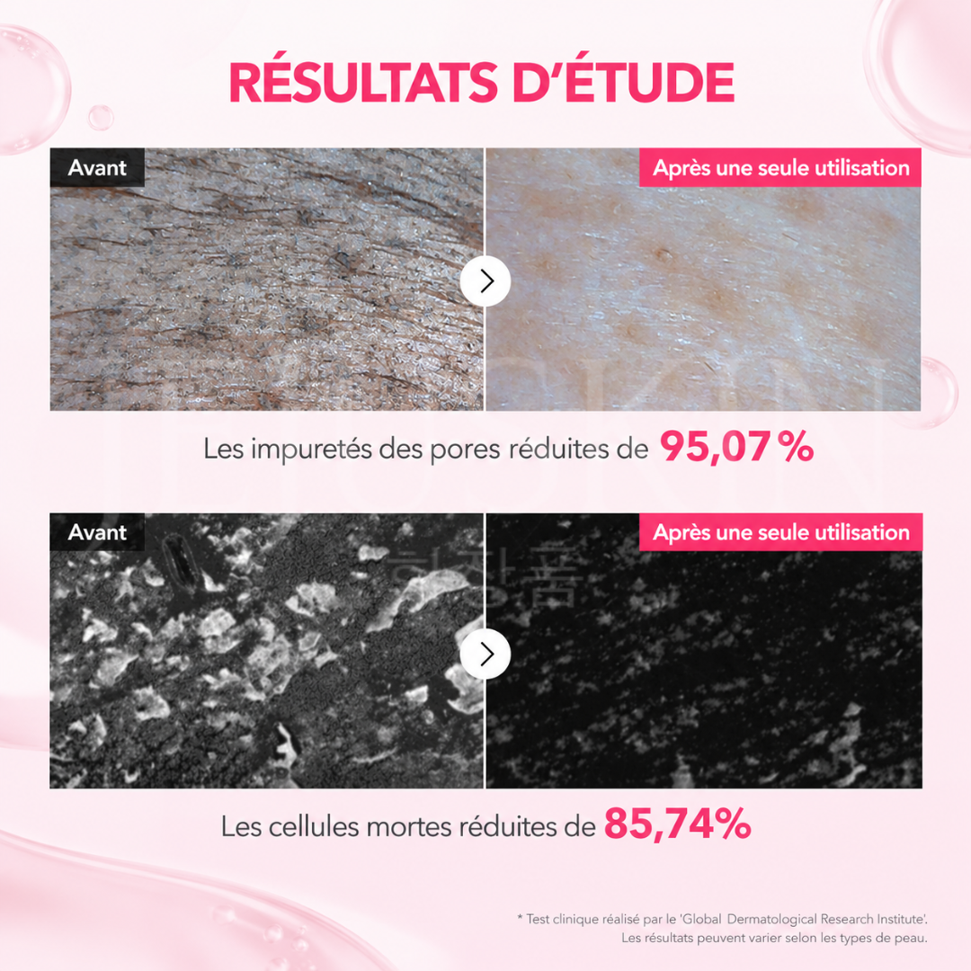 Avant après avoir utilisé le nettoyant visage purifiant au TXA et à la niacinamide d'Aprilskin