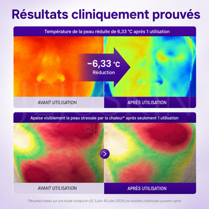 Avant après utilisation de la crème anti-âge réparatrice et raffermissante au PDRN de Centellian24