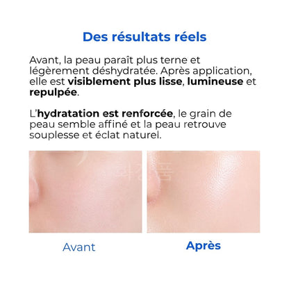 Avant après utilisation de la crème hydratante concentrée aux céramides Ato d'Illiyoon