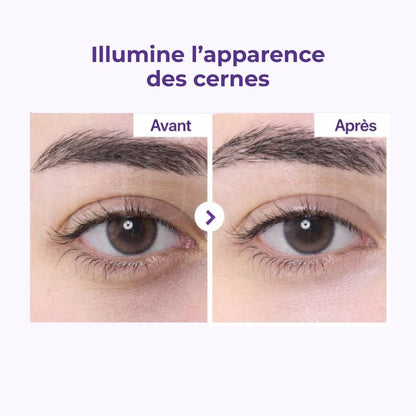 Avant après des cernes de la crème contour des yeux anti-âge au rétinol et NAD+ 