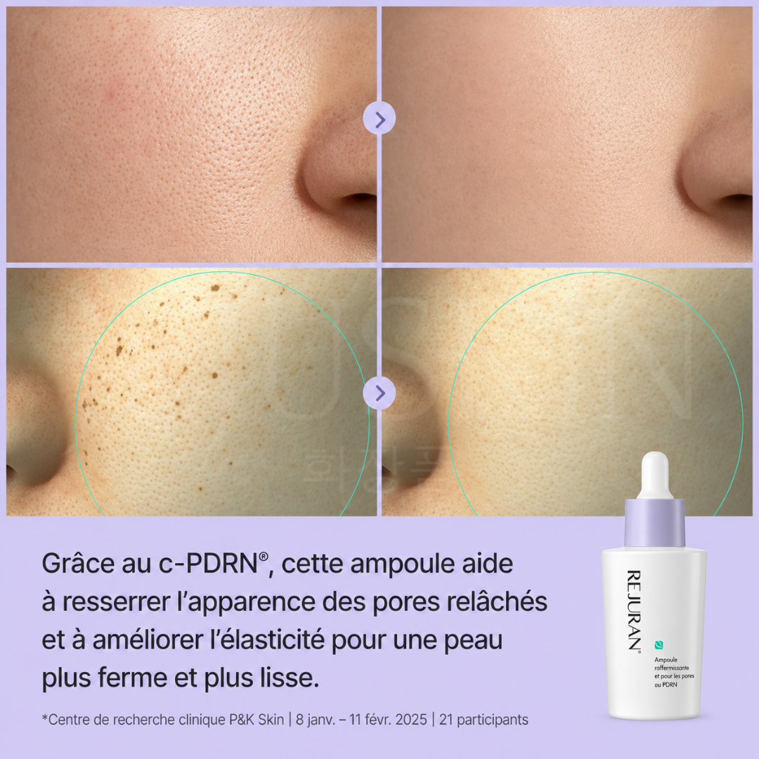 Avant après utilisation de l'ampoule raffermissante et pour les pores au PDRN de Rejuran