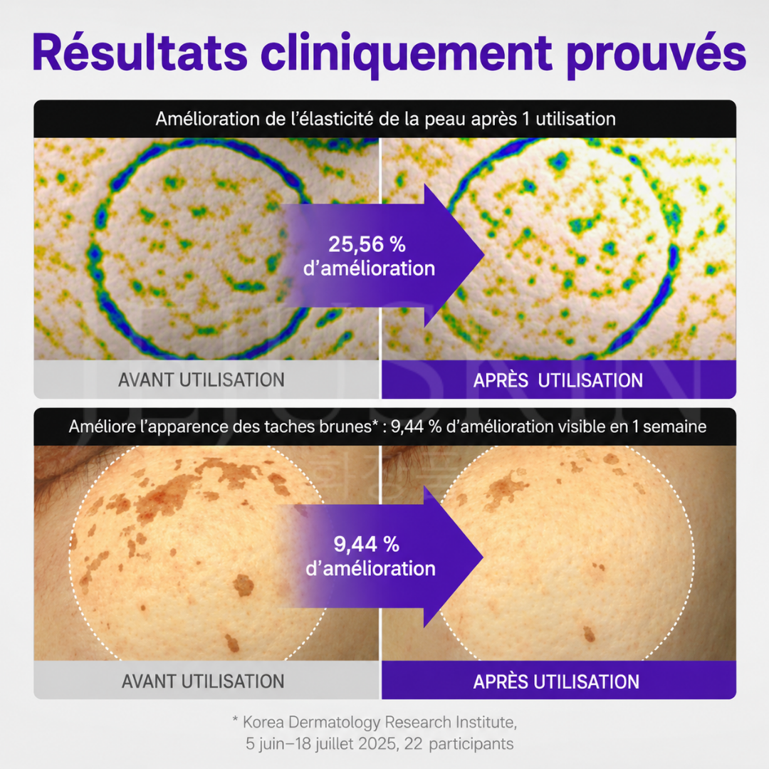 Avant après avoir utilisé la crème anti-âge réparatrice et raffermissante au PDRN de Centellian24