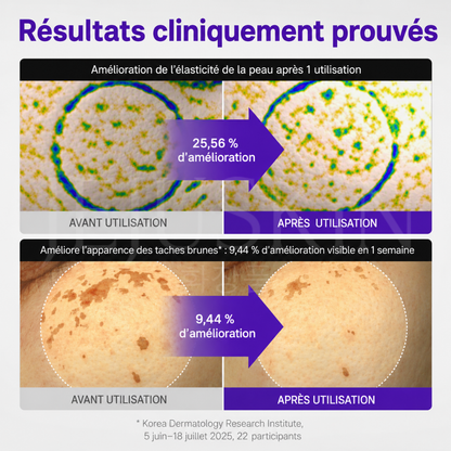 Avant après avoir utilisé la crème anti-âge réparatrice et raffermissante au PDRN de Centellian24