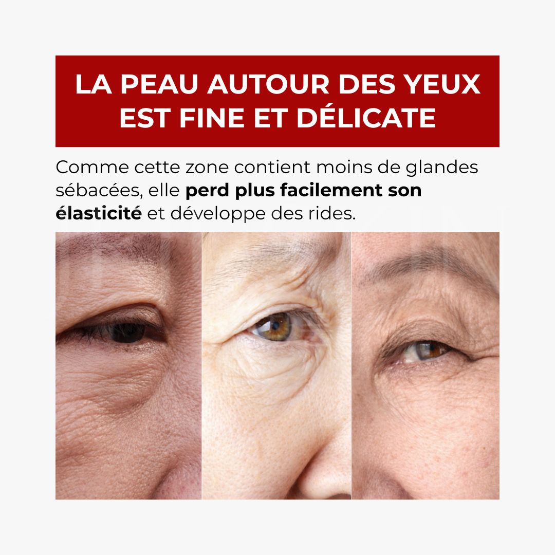 Le avant après de la crème pour le contour des yeux de medi-peel