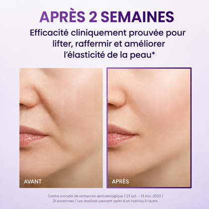 Avant après utilisation après 2 semaines de la crème anti-âge liftante et raffermissante Probioderm 3D de Bioheal Boh