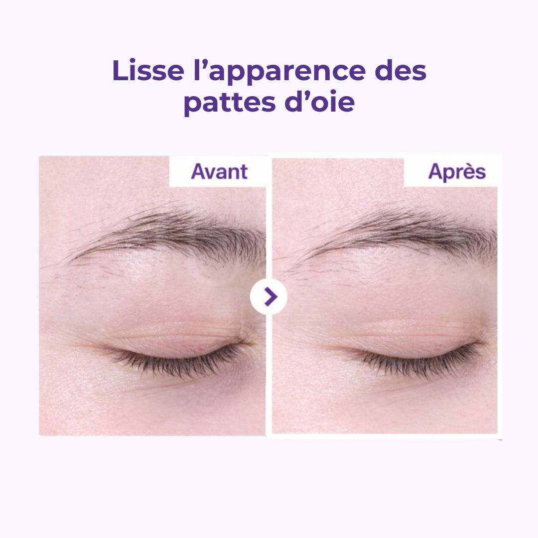 Avant après des rides de la crème contour des yeux anti-âge au rétinol et NAD+ 