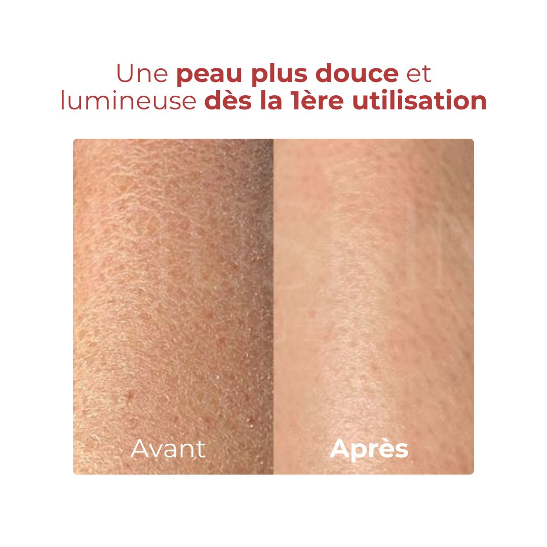 Avant après utilisation du gel exfoliant à la pêche de Plu