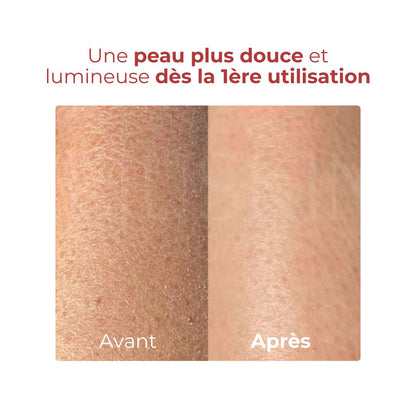 Avant après utilisation du gel exfoliant à la pêche de Plu