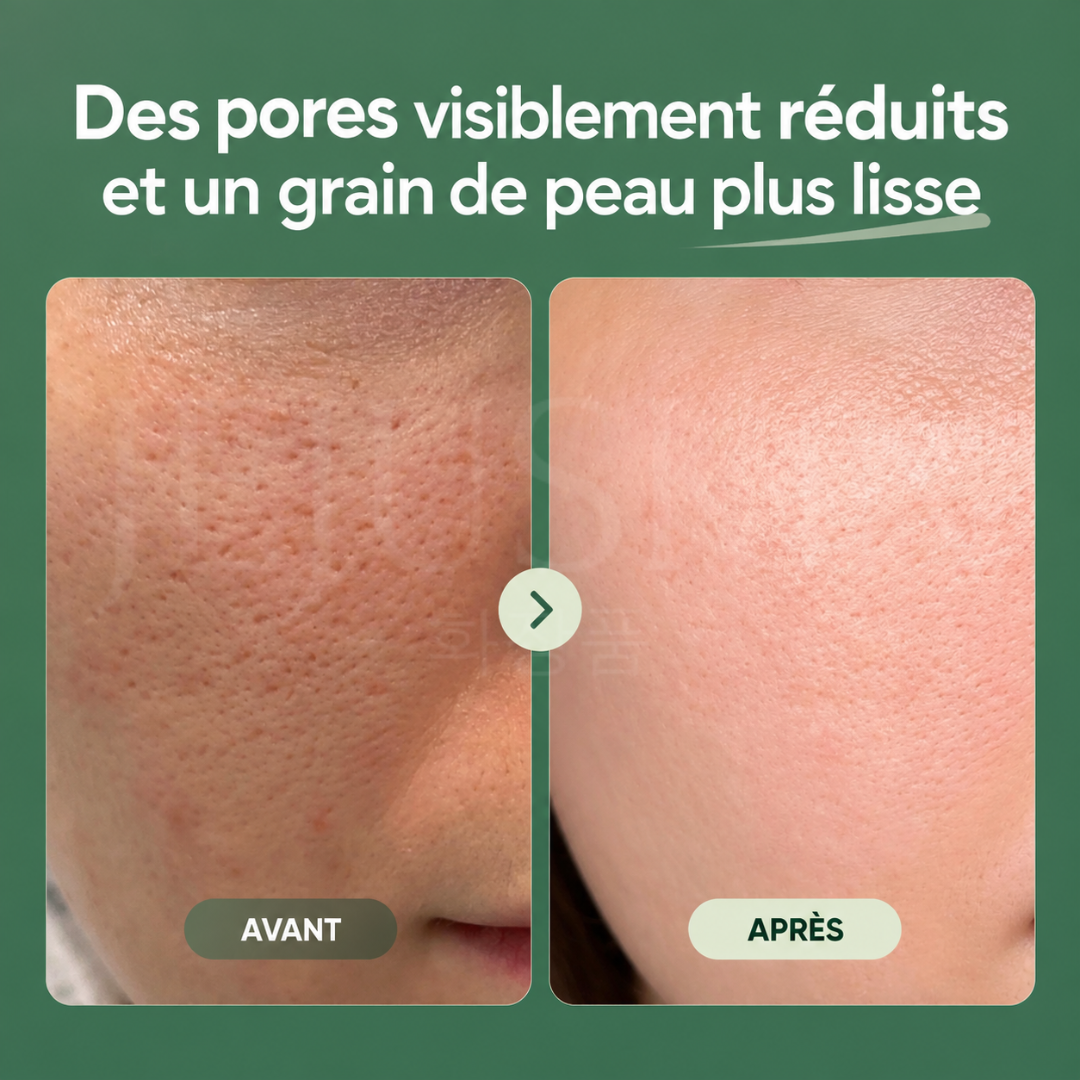 Avant après expédition des pads purifiants Heartleaf 77% d'Anua