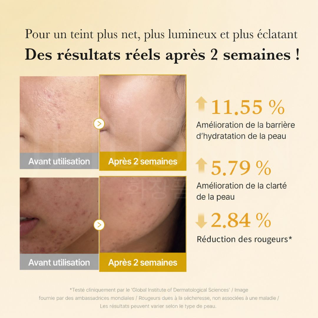 Avant après utilisation du sérum anti-taches à l’acide kojique, curcuma et niacinamide de Medicube
