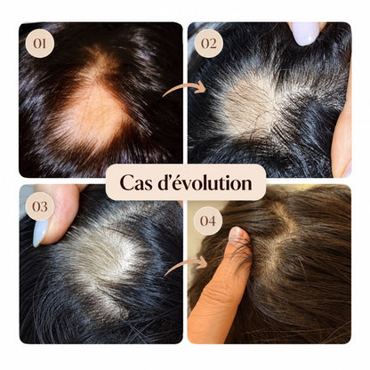 Cas d'évolution après utilisation du shampoing réparateur pour les cheveux et le cuir chevelu de Cell Happy Co