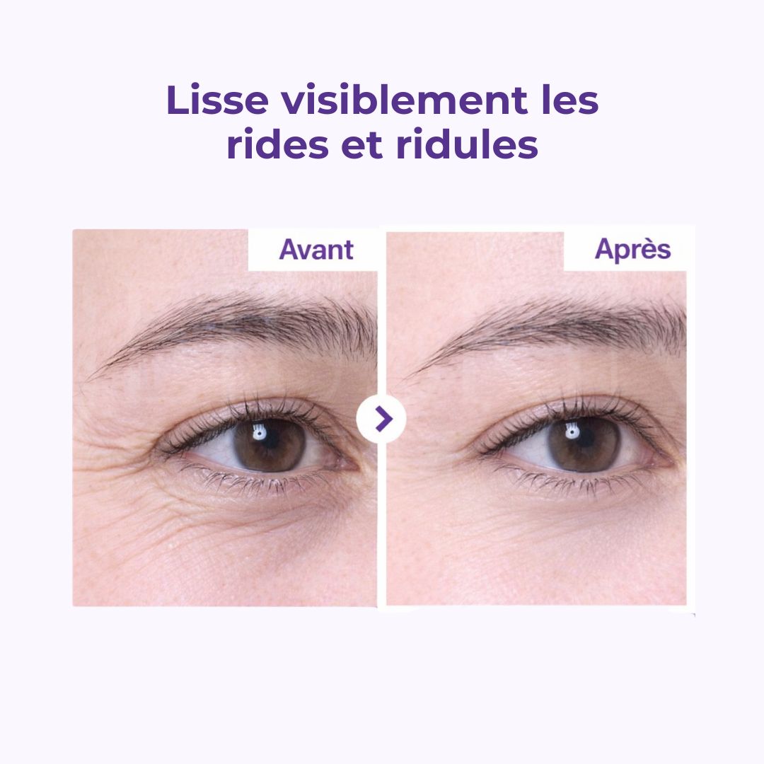 Avant après de l'apparence des rides de la crème contour des yeux anti-âge au rétinol et NAD+ 