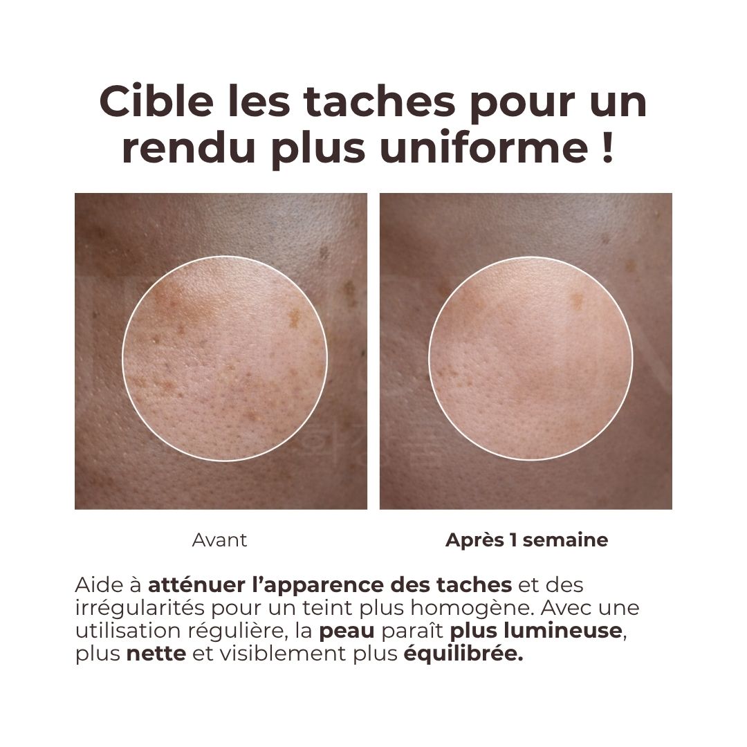Avant après avoir utilisé la crème hydratante et réparatrice aux Céramides de Dr. Reju-All