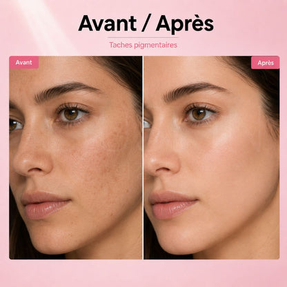 Avant après utilisation du sérum anti-imperfections et tâches d'Isoi