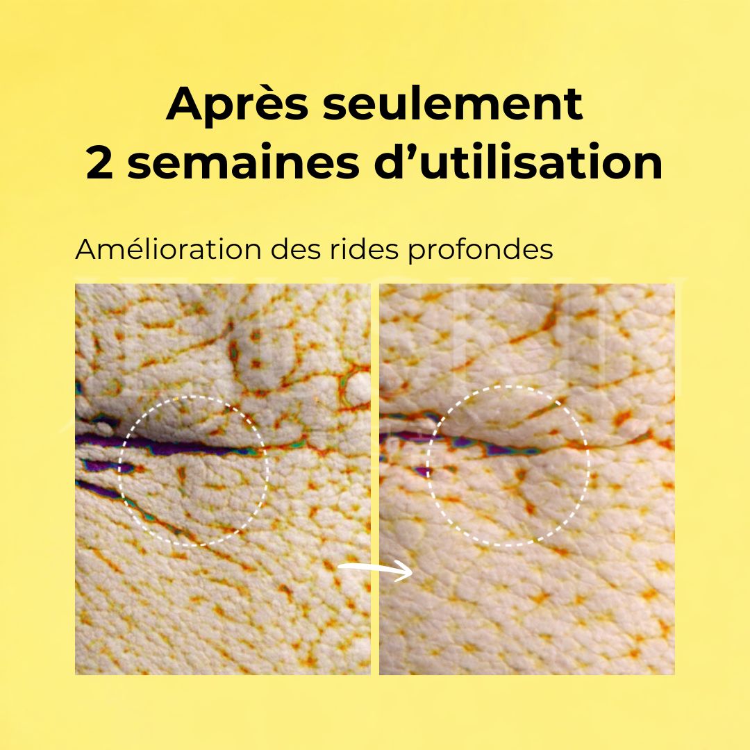 Avant après l'utilisation du serum au retinal de celimax