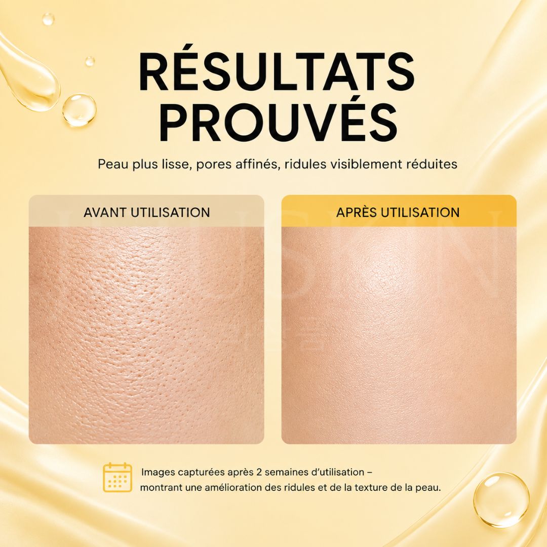 Arencia Sérum booster anti-âge concentré au rétinal résultat avant après