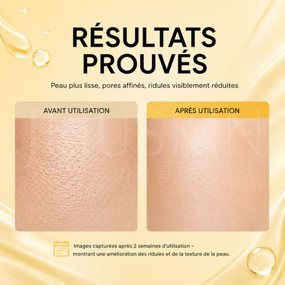 Arencia Sérum booster anti-âge concentré au rétinal résultat avant après