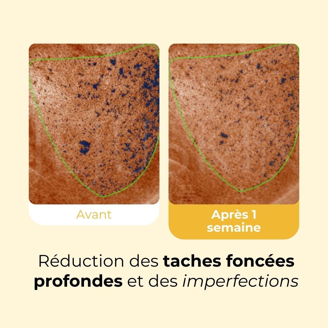 Avant après avoir utiliser la crème Celimax