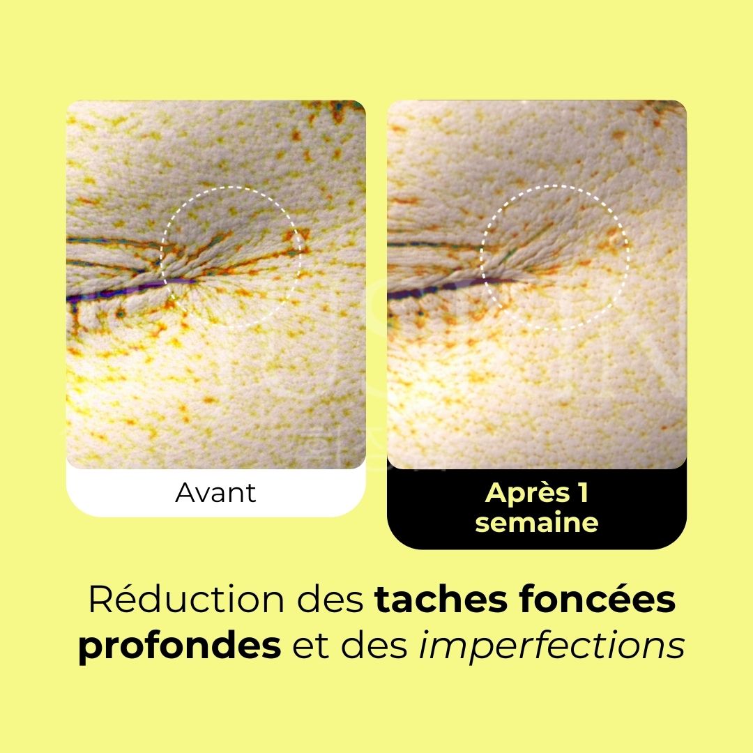 Avant après du sérum lissant au rétinol Vita A