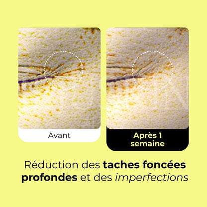 Avant après du sérum lissant au rétinol Vita A