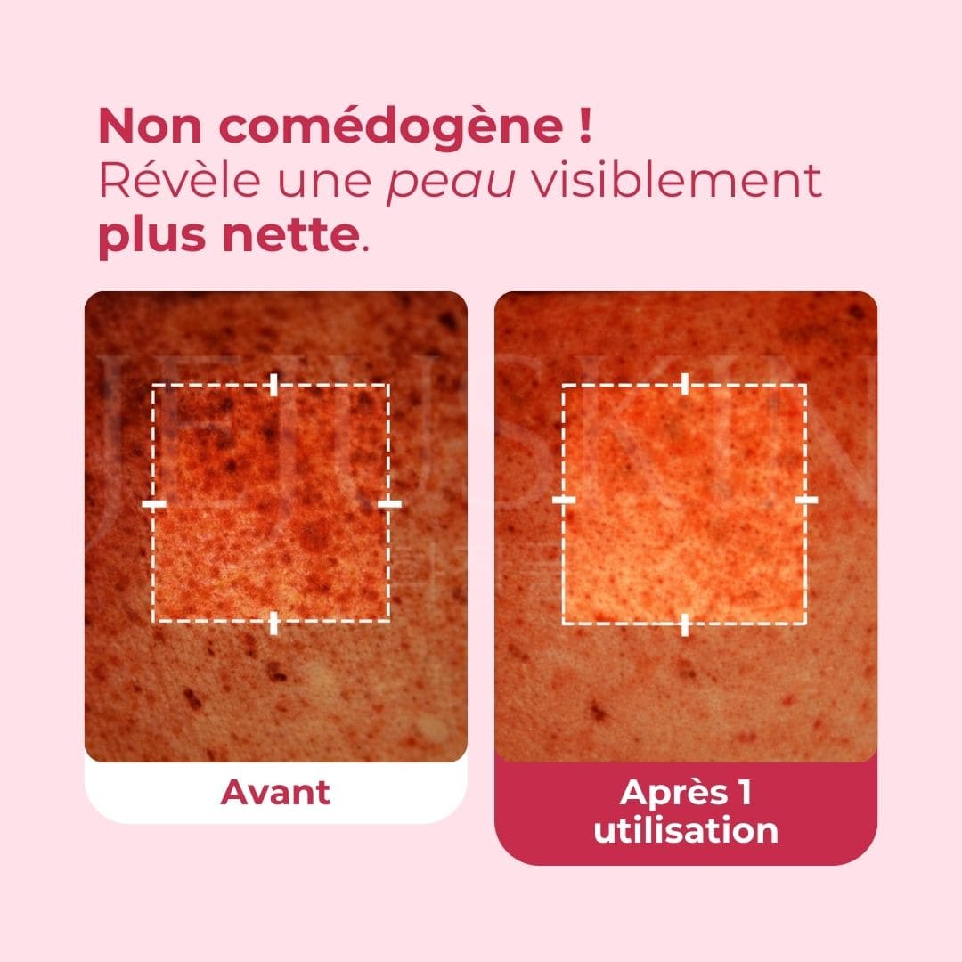 Avant après utilisation de la crème capsule TXA et Niacinamide de Medicube