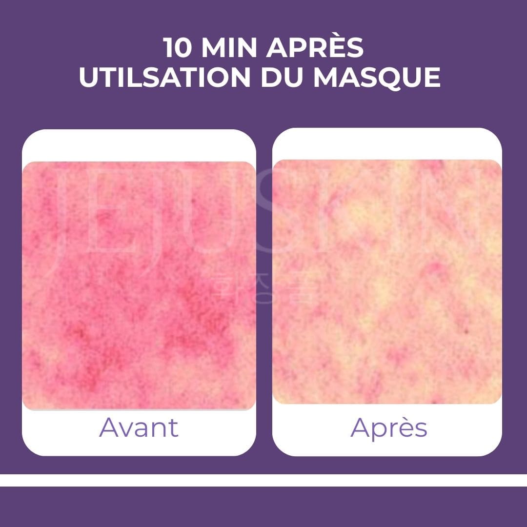Be-Hope - Masque végan apaisant et hydratant pour une peau lumineuse avant après