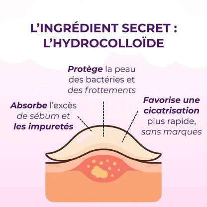 Catch Me Patch Patchs anti-imperfections hydrocolloide