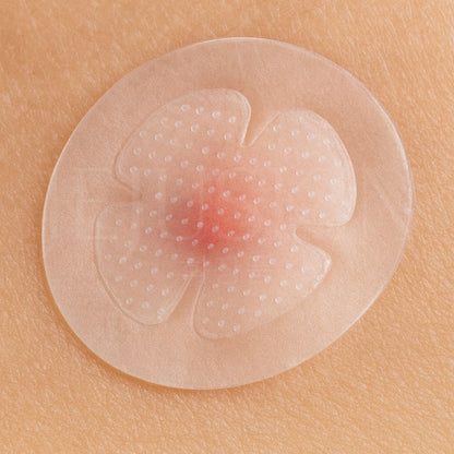 Catch Me Patch Patchs micro-aiguilles hydratants et apaisants pour boutons naissants photo