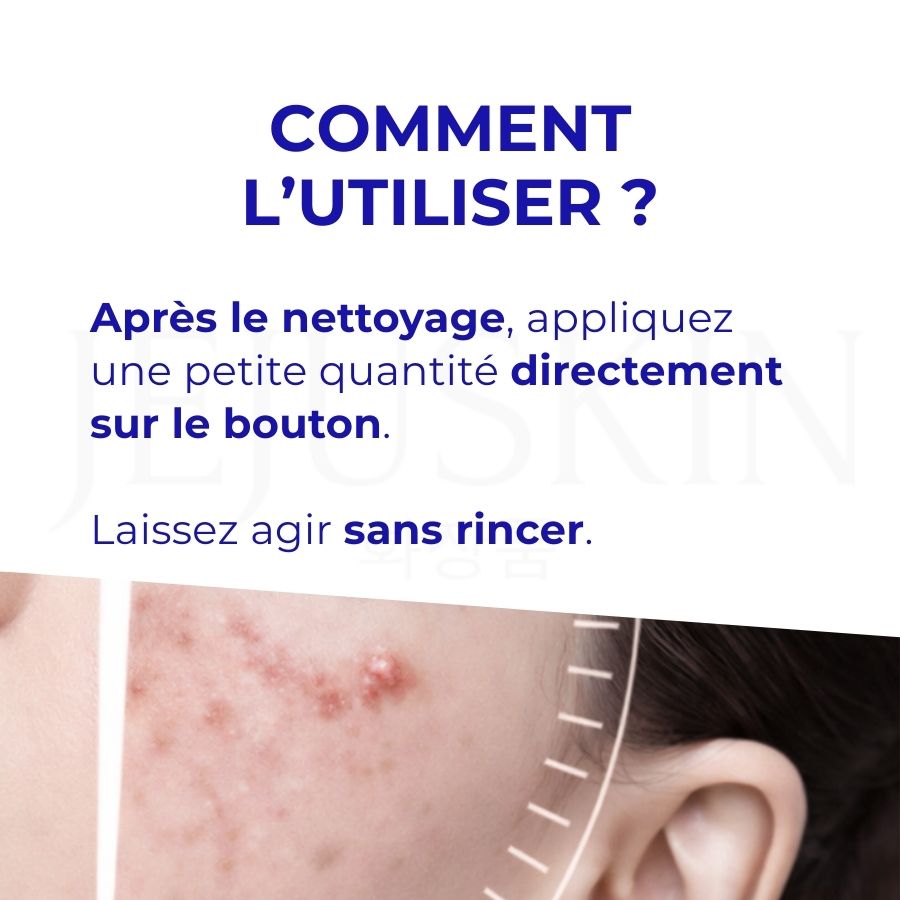 Conseil d'utilisation de la crème anti-acné Lion
