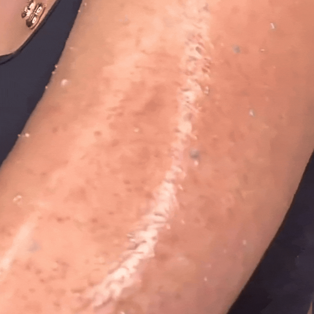 Vidéo de l'exfoliant pour le corps à l’acide hypochloreux de Medicube