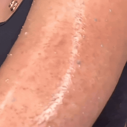 Vidéo de l'exfoliant pour le corps à l’acide hypochloreux de Medicube