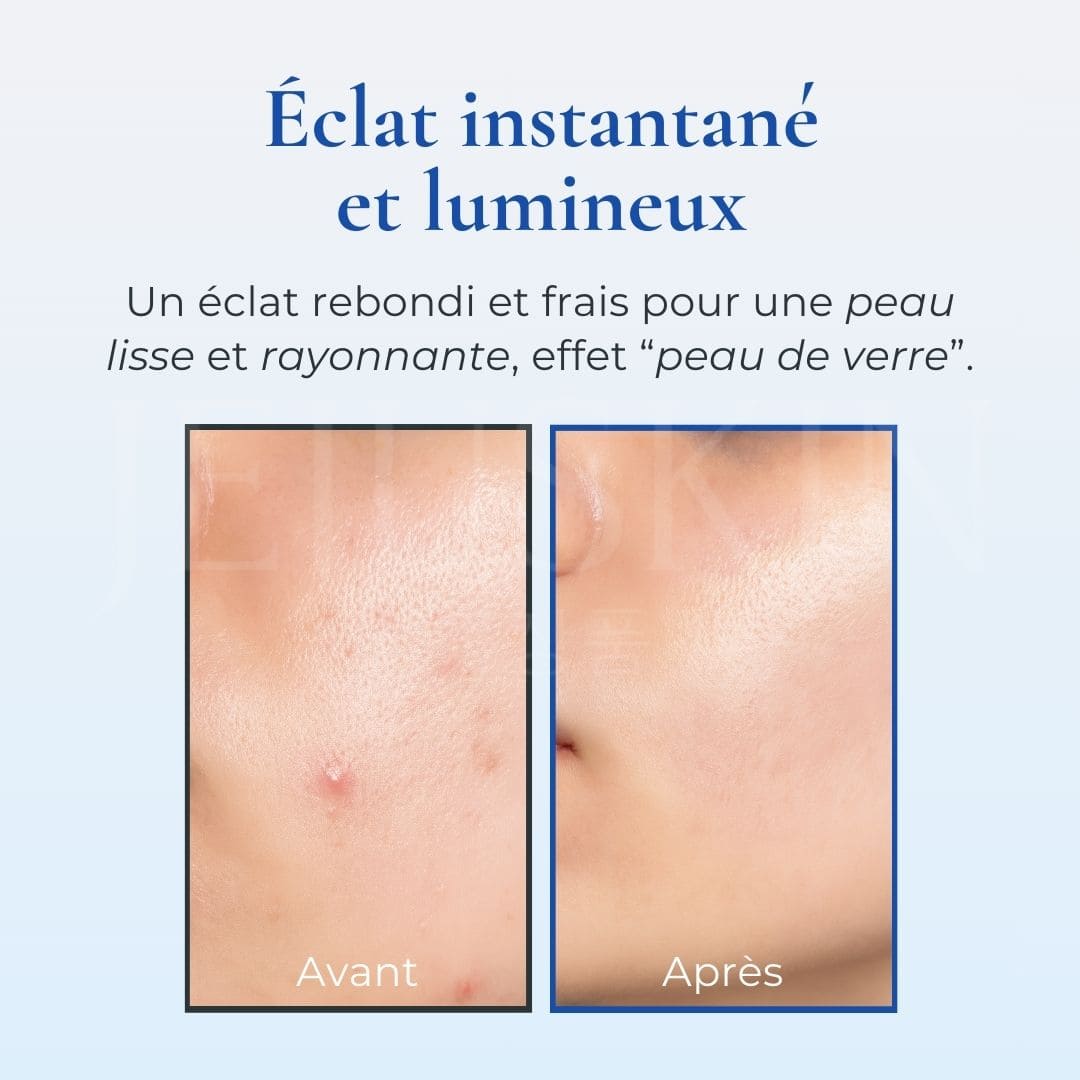 Dr.Althea Brume gélifiée hydratante Aqua Marine avant après