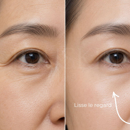 Avant-après : comment lisser les rides du contour des yeux et rajeunir le regard ?
