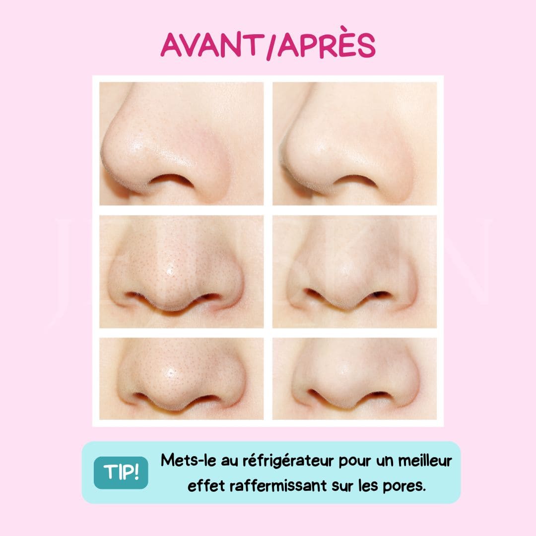 Holika Holika Patchs anti-points noirs pour le nez avant après