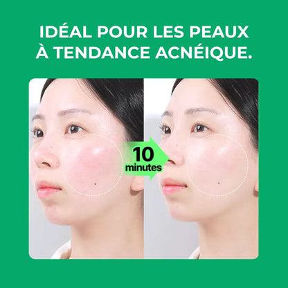 Ilso soin adoucissant anti-imperfections avant après