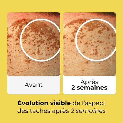 Image d'un avant après sur des taches de la crème capsules d'alba