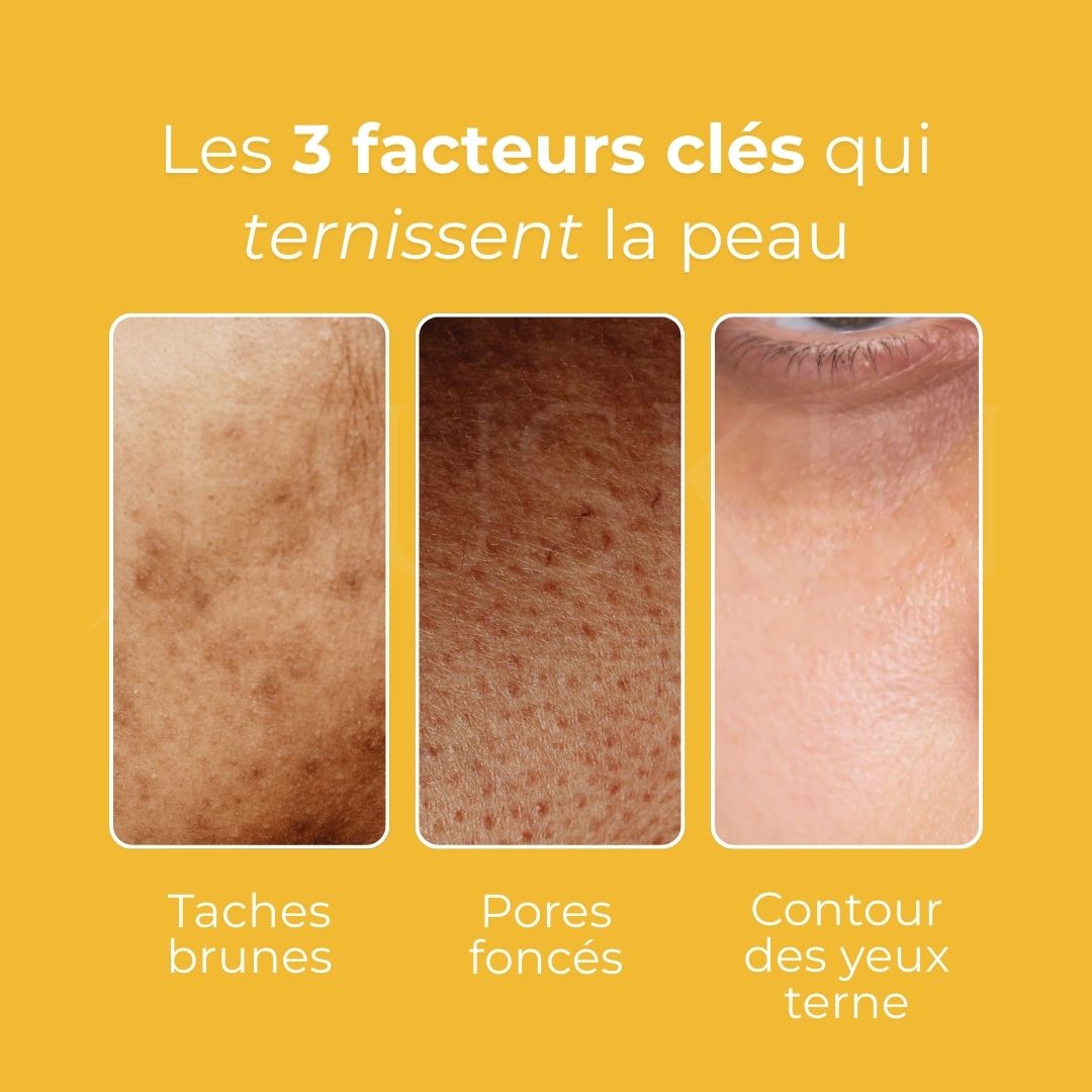 Image des 3 facteurs qui ternissent la peau