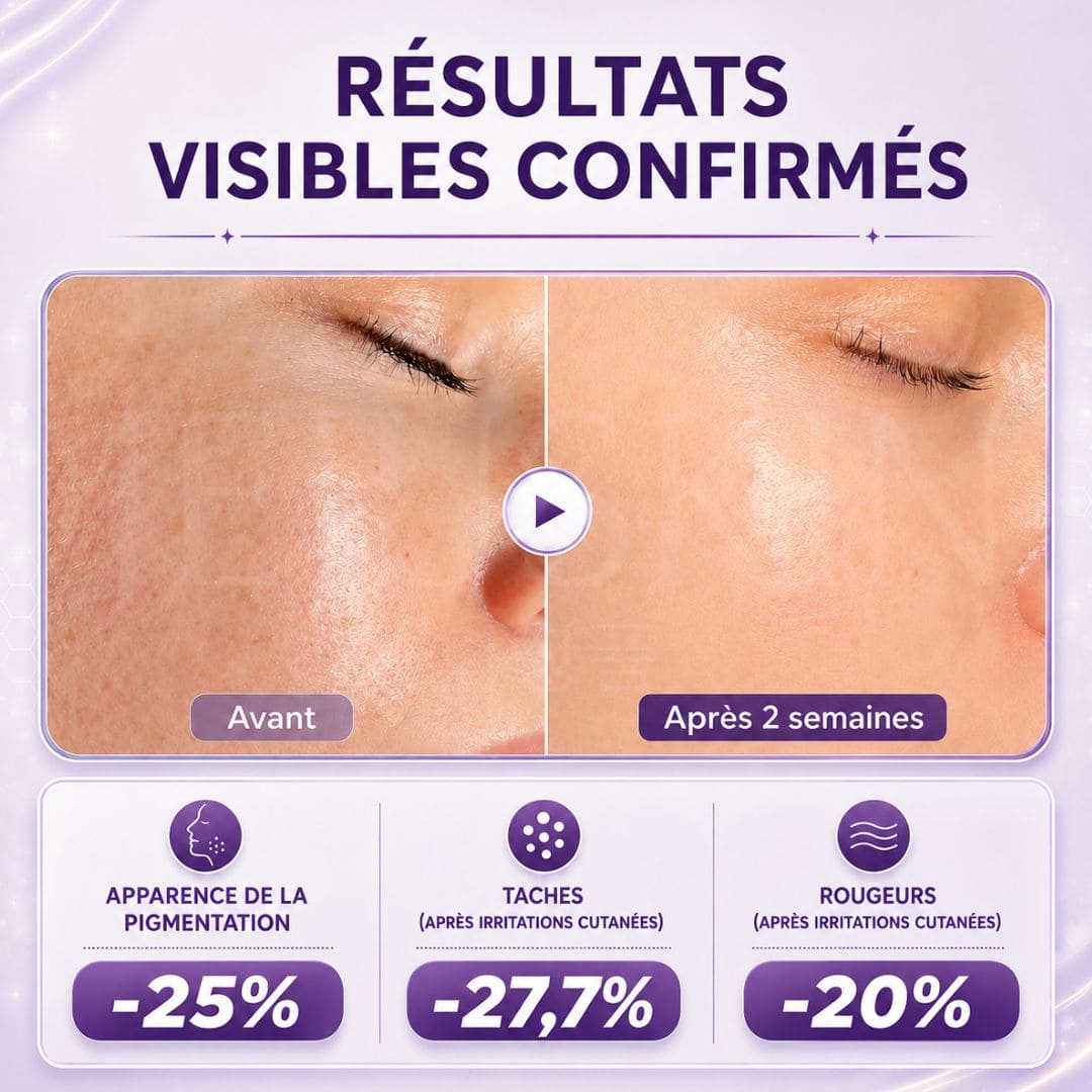 Jumiso Sérum anti-taches à la niacinamide 20%  résultats visibles  