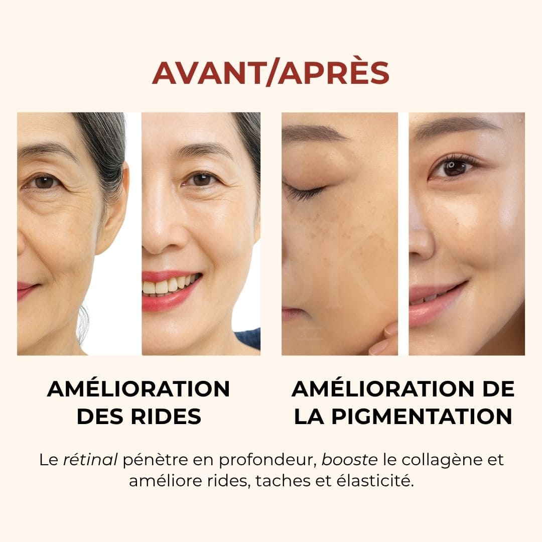 K-Secret Sérum SEOUL 1988 Rétinal avant après