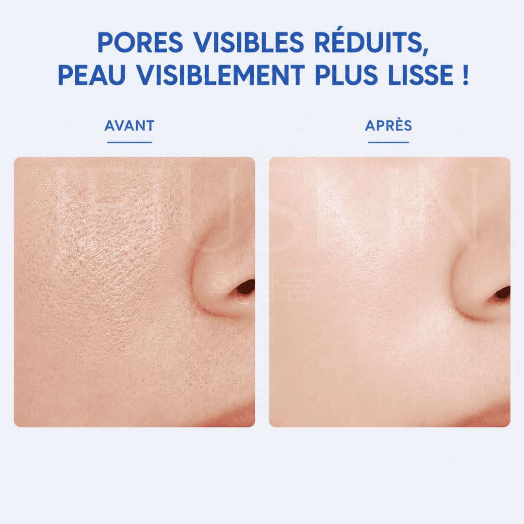 Medicube Crème hydratante Zéro pore 2.0 avant après 