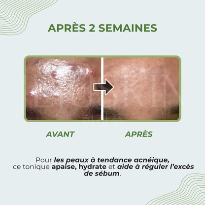Numbuzin Toner apaisant aux herbes Pure-Full avant après