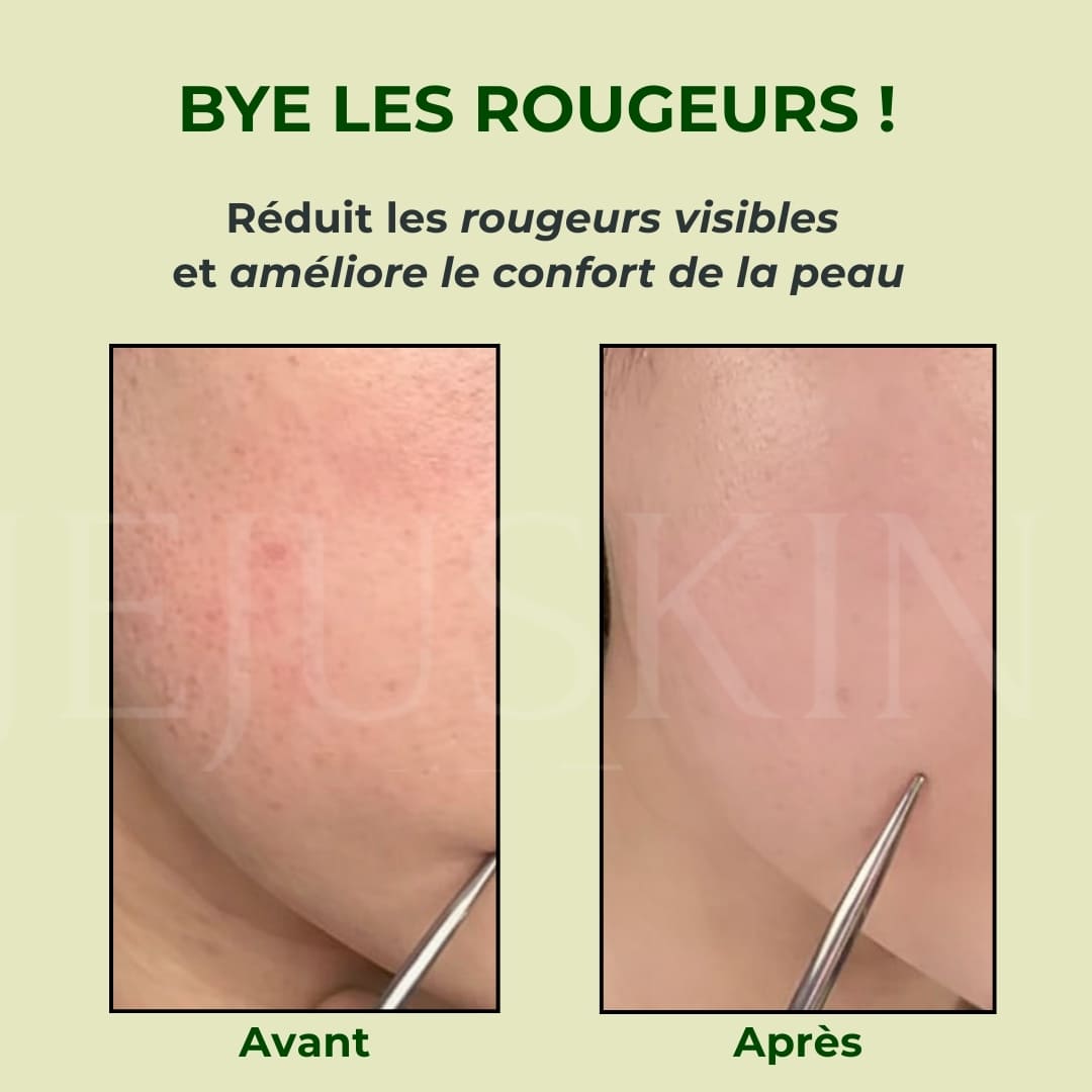 Orien Toner apaisant à l’armoise avant après