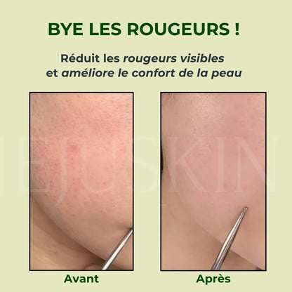 Orien Toner apaisant à l’armoise avant après