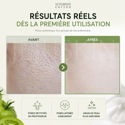 Sungboon Editor  Mousse nettoyante ultra-riche pour les pores à la tomate verte résultats avant après 