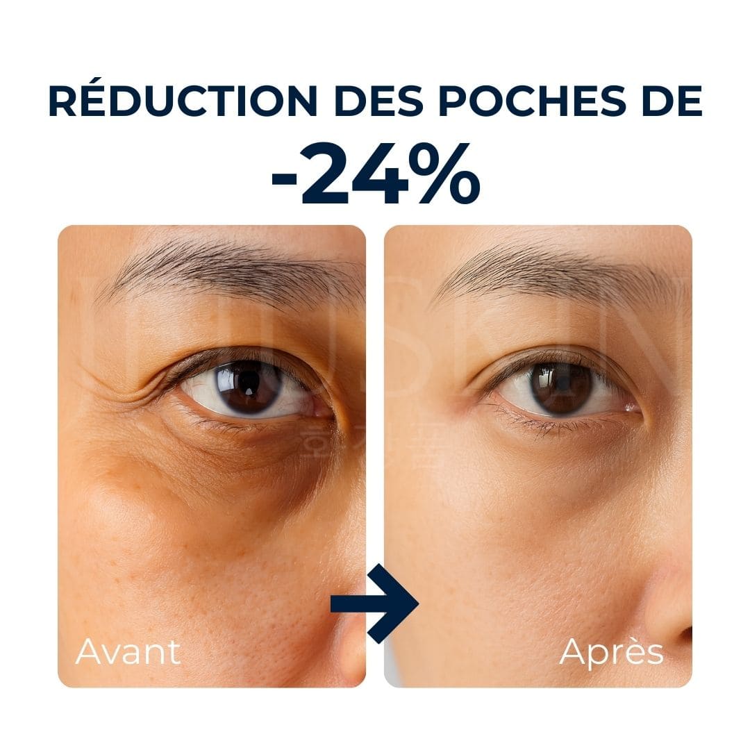 avant après crème vt cosmetics